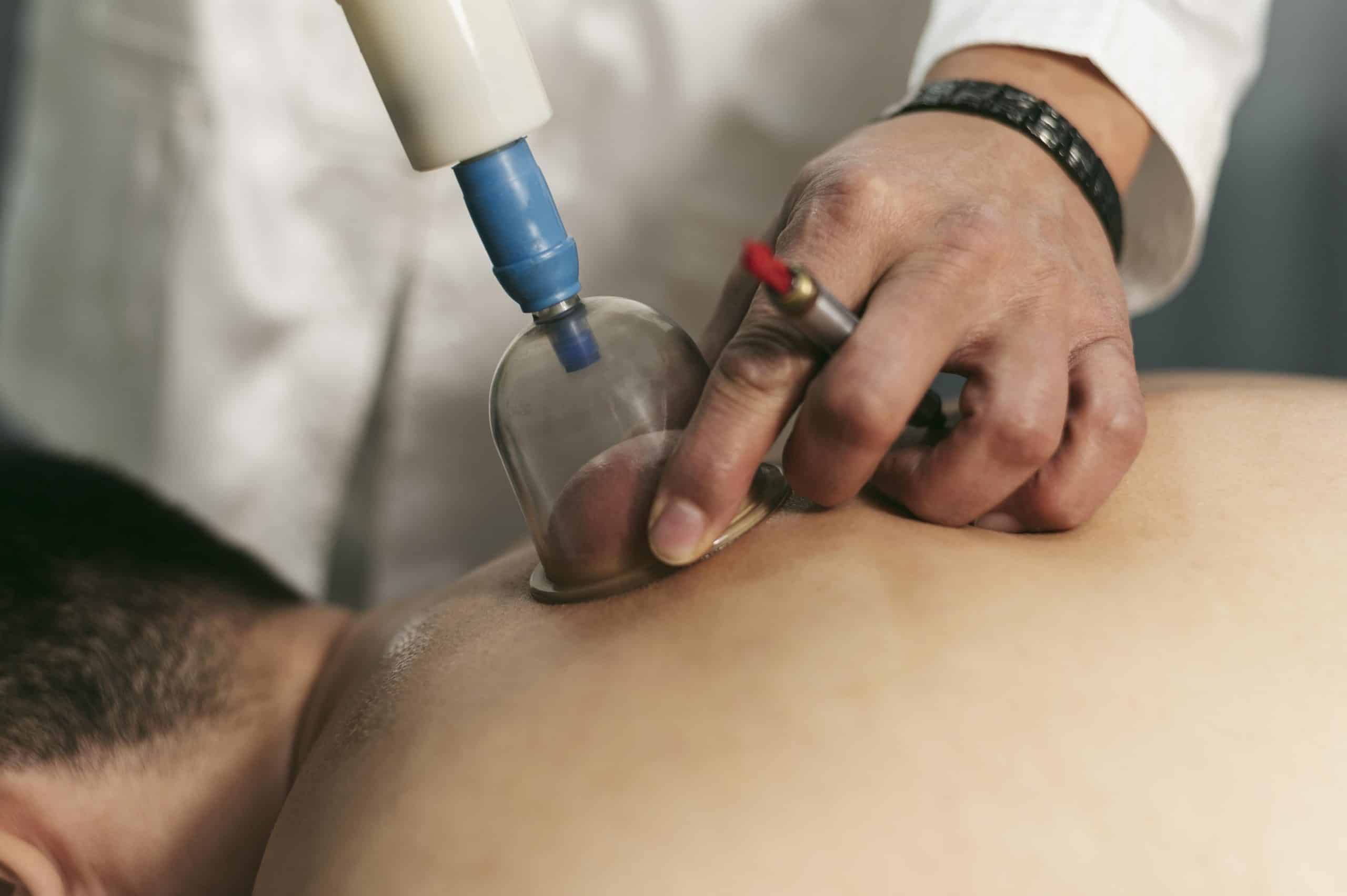Dry Cupping Therapy-04